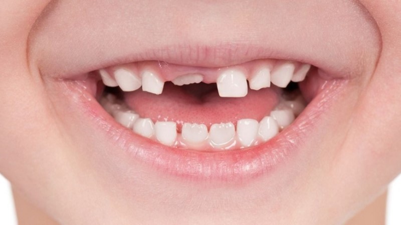 Các con số may mắn khi mơ thấy rụng răng ở hàm trên