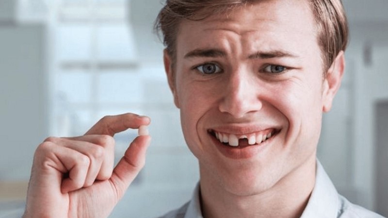Nằm mơ thấy rụng răng báo điềm tốt hay xấu